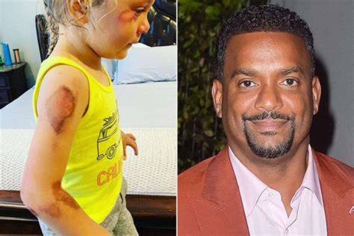 Alfonso Ribeiro Daughter Accident Surgery, Recovery Closer Weekly