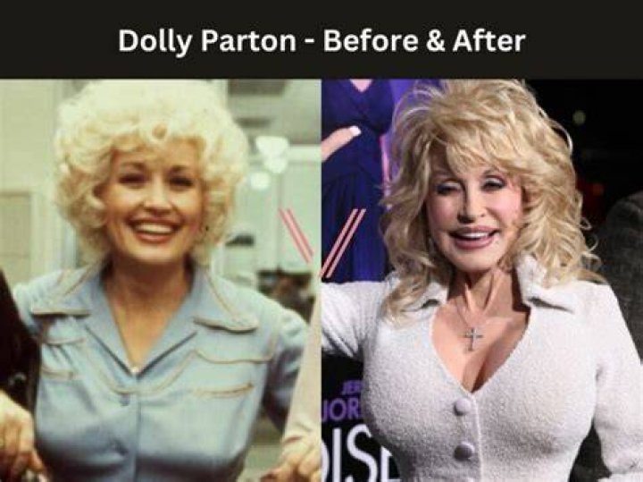 Are Dolly Partons Boobs Real Telegraph