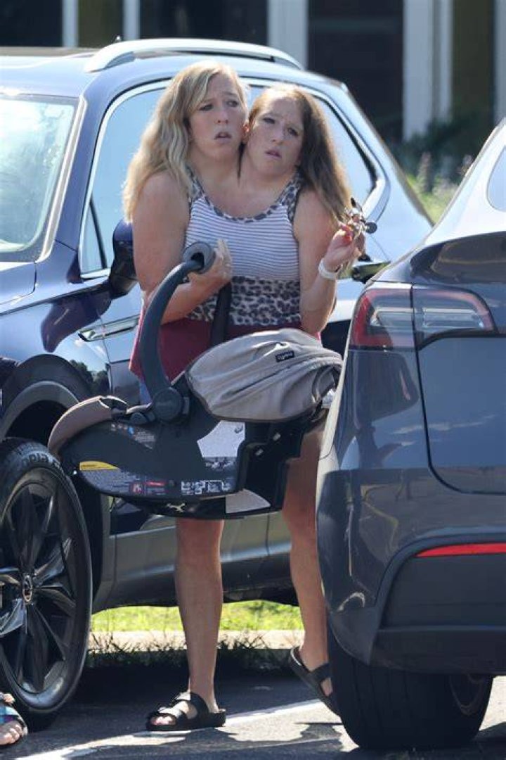 Here&rsquo;s What Conjoined Twins Abby And Brittany Hensel Look Like Today